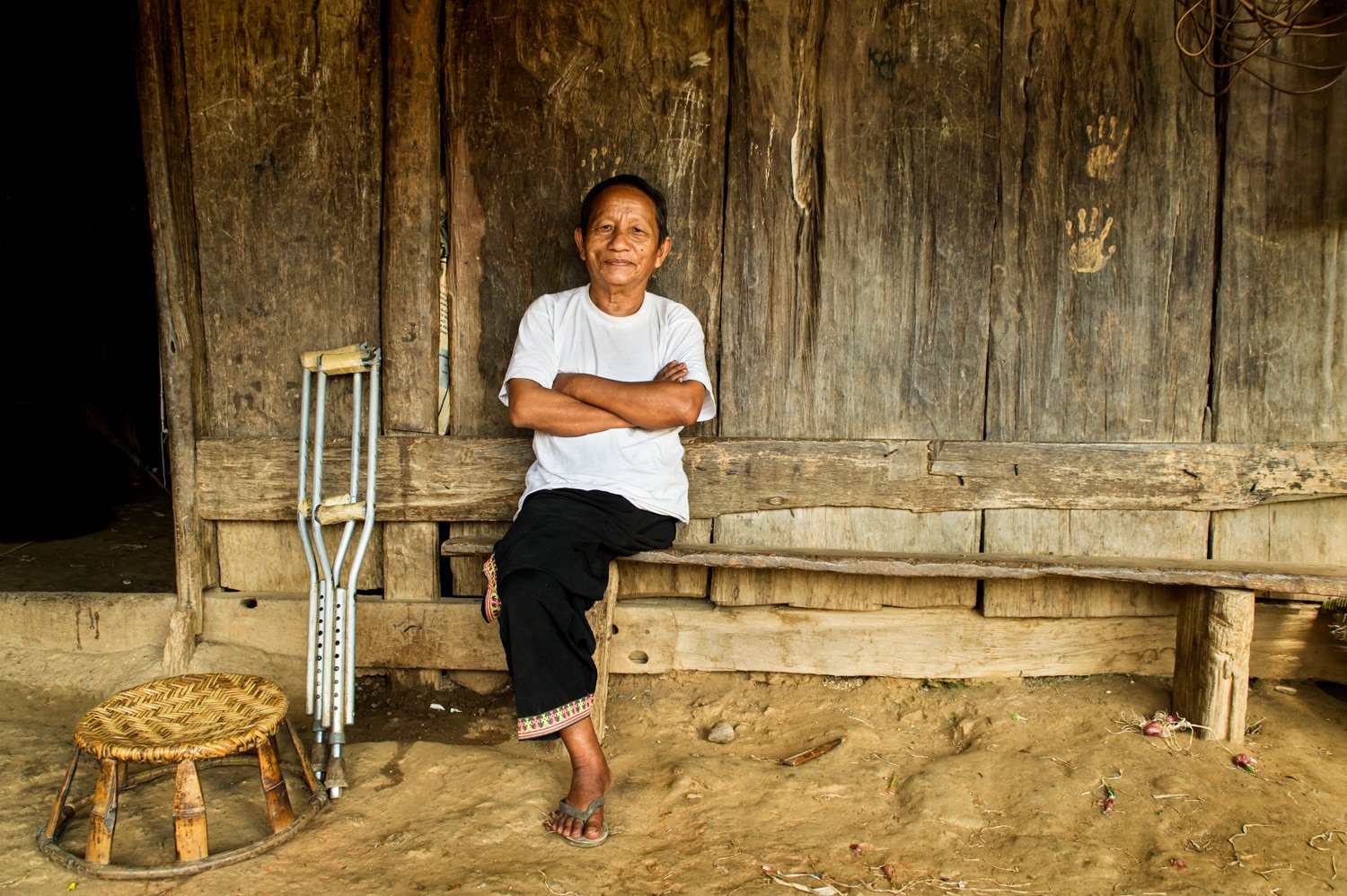 Portfolio of KevinLJ © Kevin Landwer-Johan Hmong Amputee